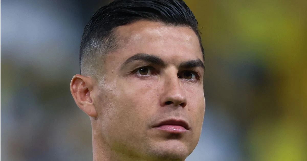 Karena Cristiano Ronaldo Takut Botak